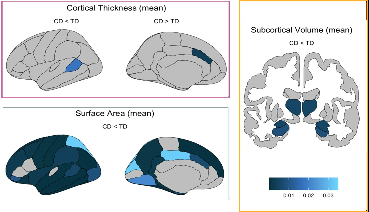 Youth with conduct disorder show widespread differences in brain ...