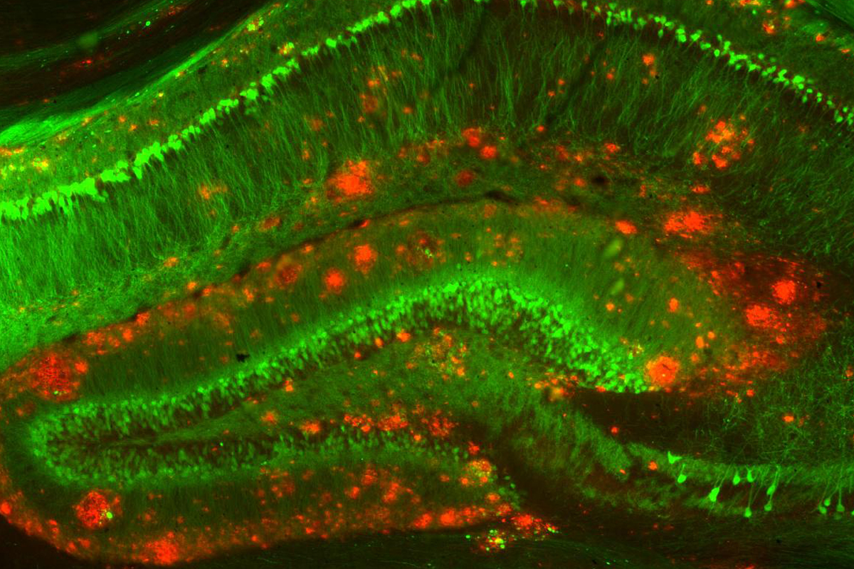 Cells in a mouse brain with green neurons and red amyloid beta clusters.