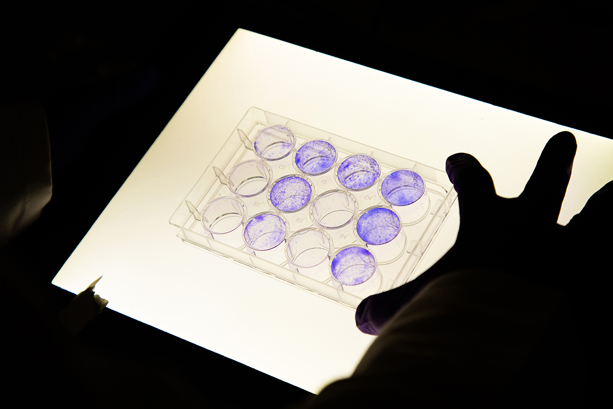 Scientist’s hand as they study gynecological cancers.