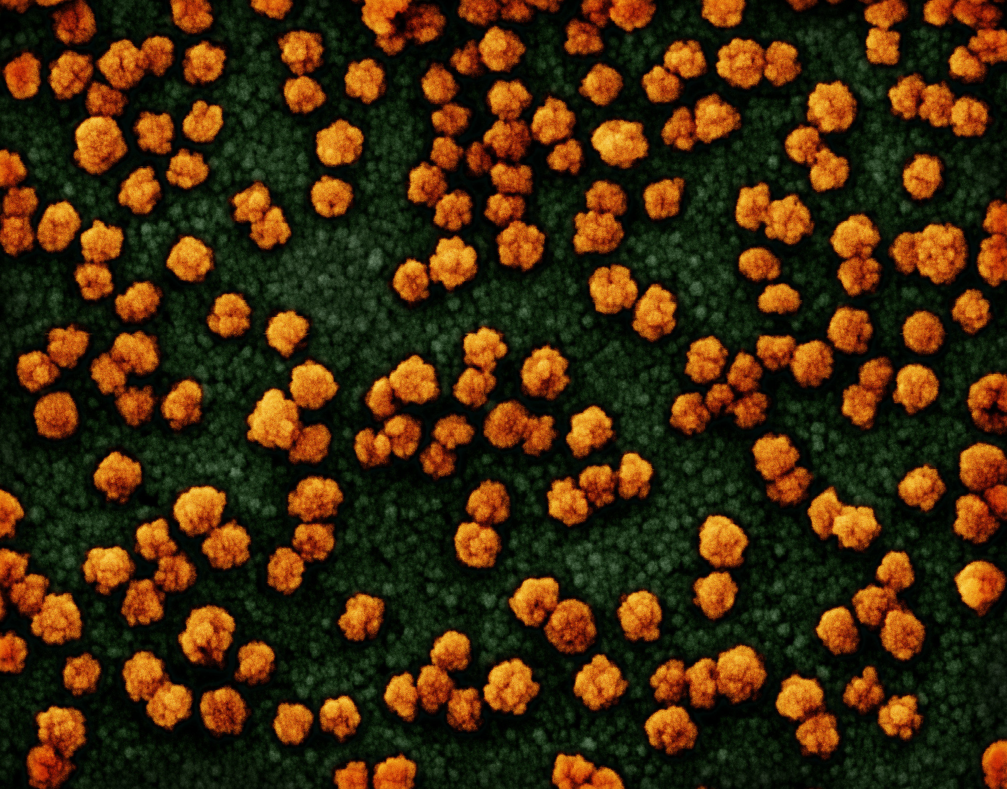 Novel Coronavirus SARS-CoV-2 Novel Coronavirus SARS-CoV-2