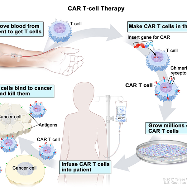 CAR T-Cell Therapy