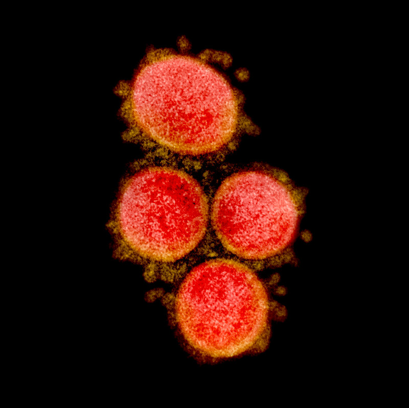 Novel Coronavirus SARS-CoV-2