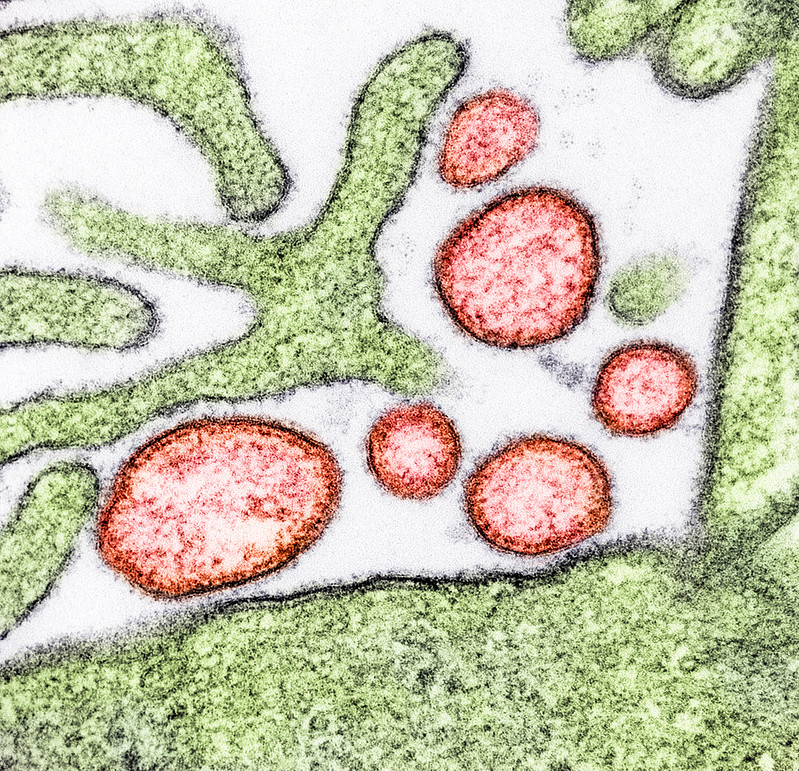 Colorized transmission electron micrograph of mature extracellular Nipah Virus particles (red) near the periphery of an infected VERO cell (green).