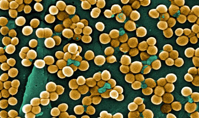 Clusters of round, golden bacteria