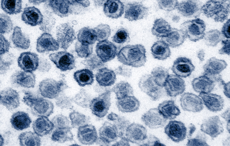 Transmission electron micrograph of round virus particles