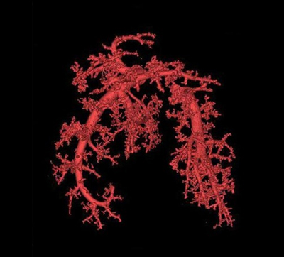 Image of blood vessels in lung