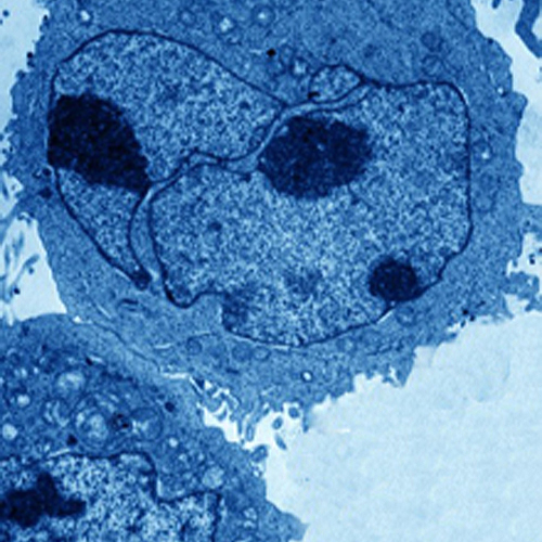 Transmission electron micrograph of a lymphoblast.