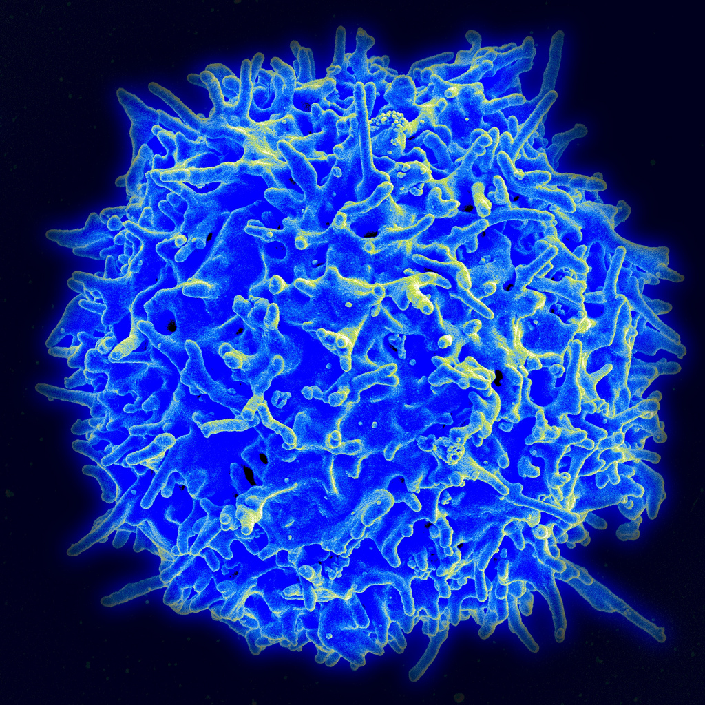 Scanning electron micrograph of a human T cell