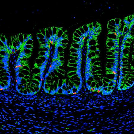 Human intestinal organoids in mouse intestine