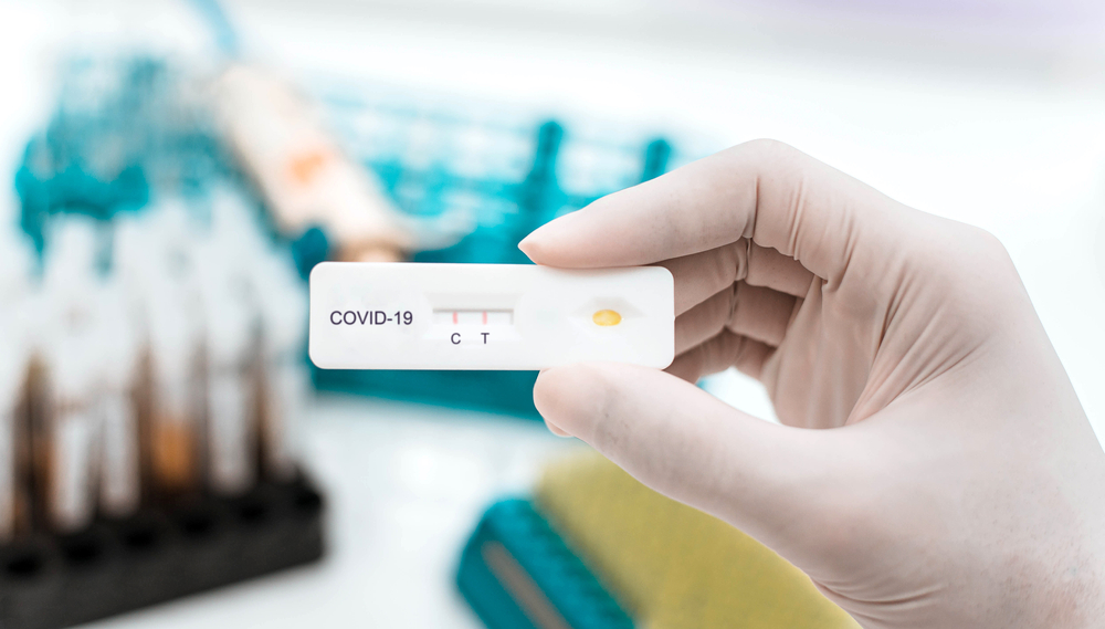 SARS-CoV-2 rapid antigen test kit SARS-CoV-2 rapid antigen test kit