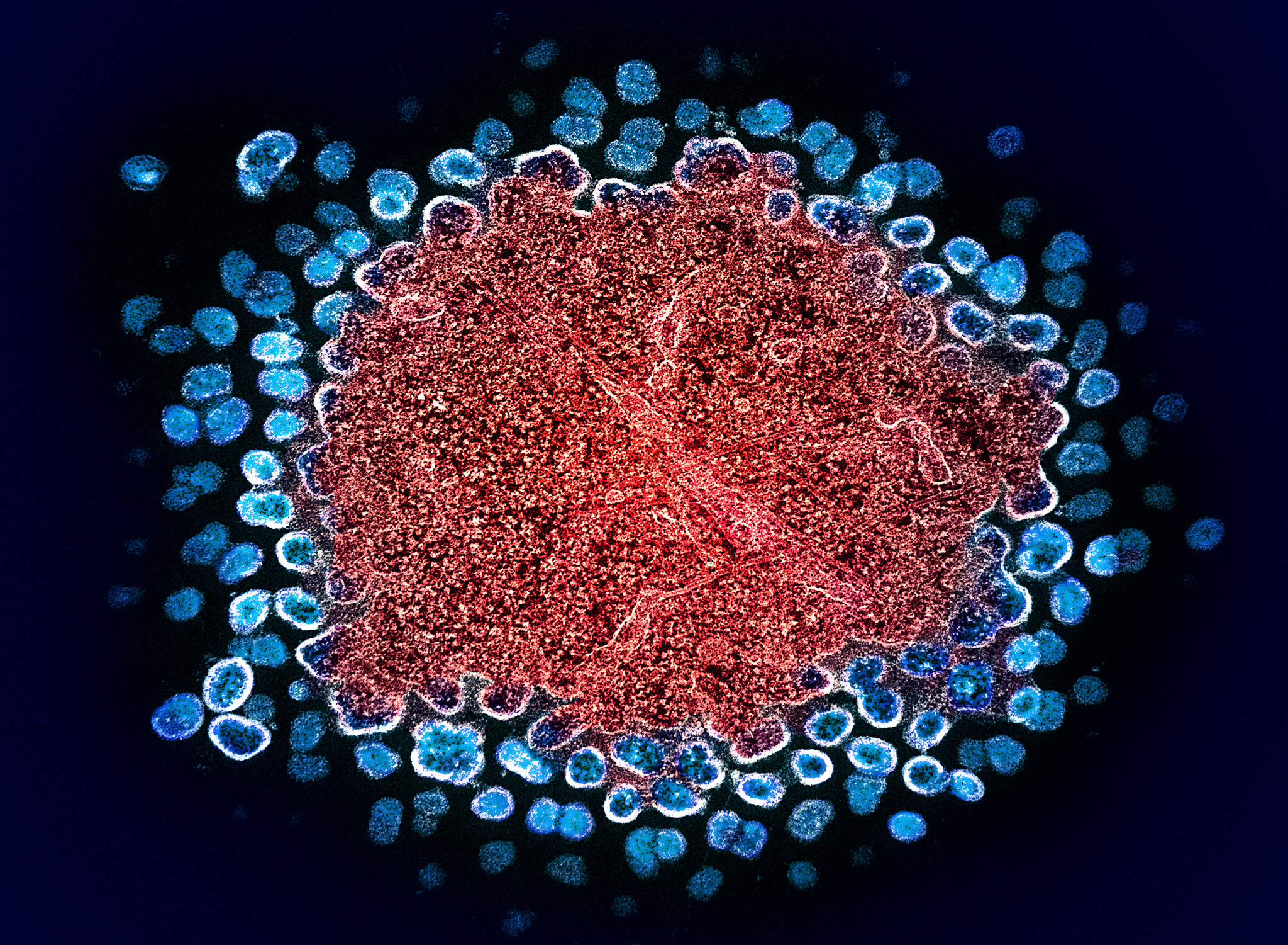 Numerous HIV particles surrounding a cell, with some emerging from it