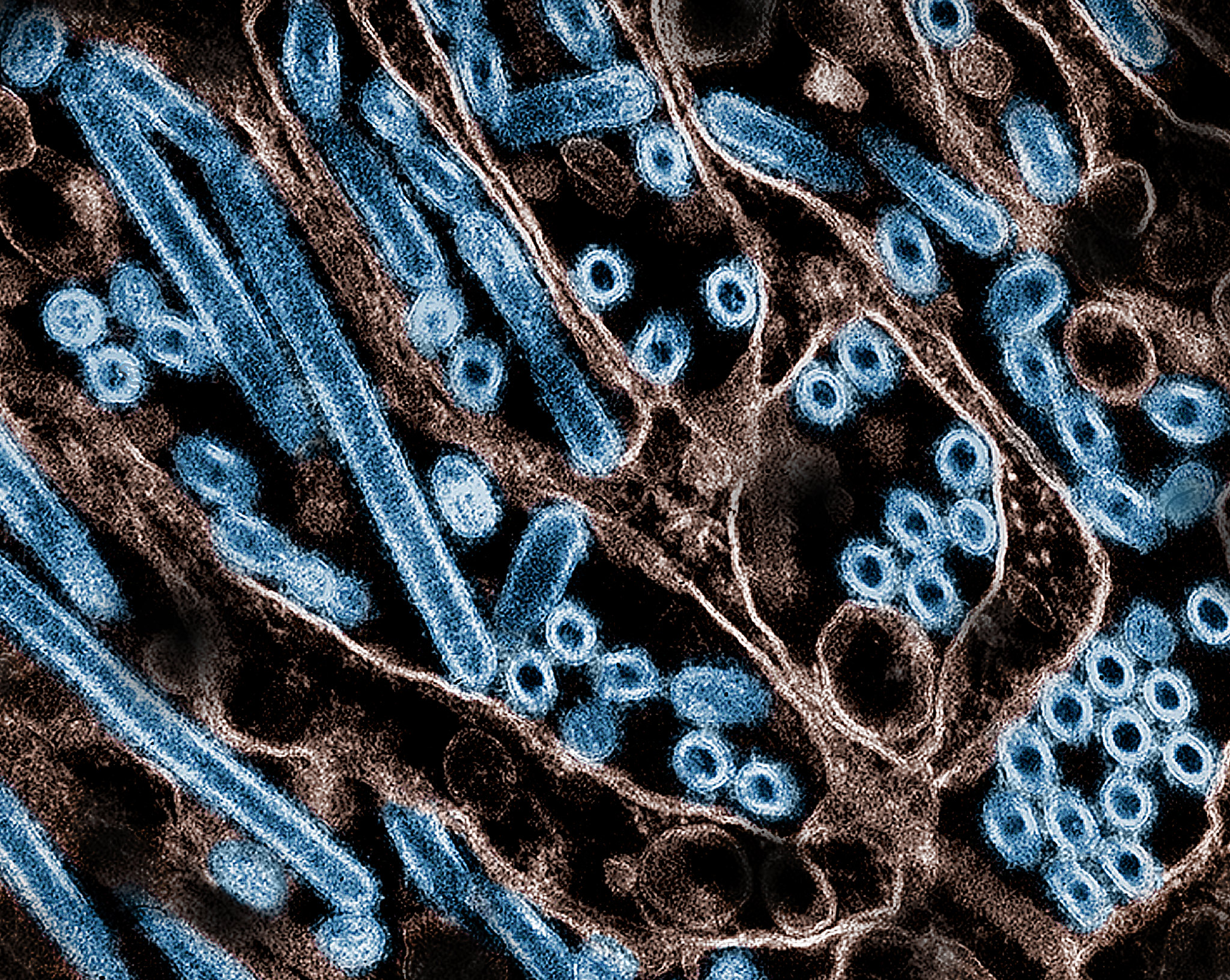 Electron micrograph shows long rods and circular cross-sections of virus particles.