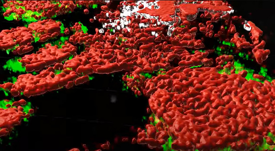 Screenshot of video describing how the complexity of tumors has been revealed in 3D.