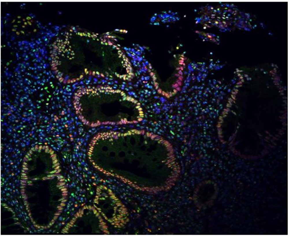 Immunofluorescence signal is strong in the epithelial cells surrounding colon spaces.