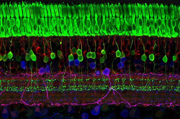 Image capturing the layers of nerve cells in the retina. The top layer (green) is made up of cells called photoreceptors that convert light into electrical signals to relay to the brain.