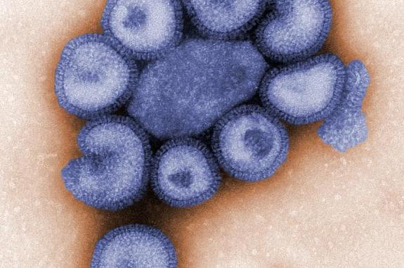 Electron microscope image shows several rounded influenza virus particles with outer layers.