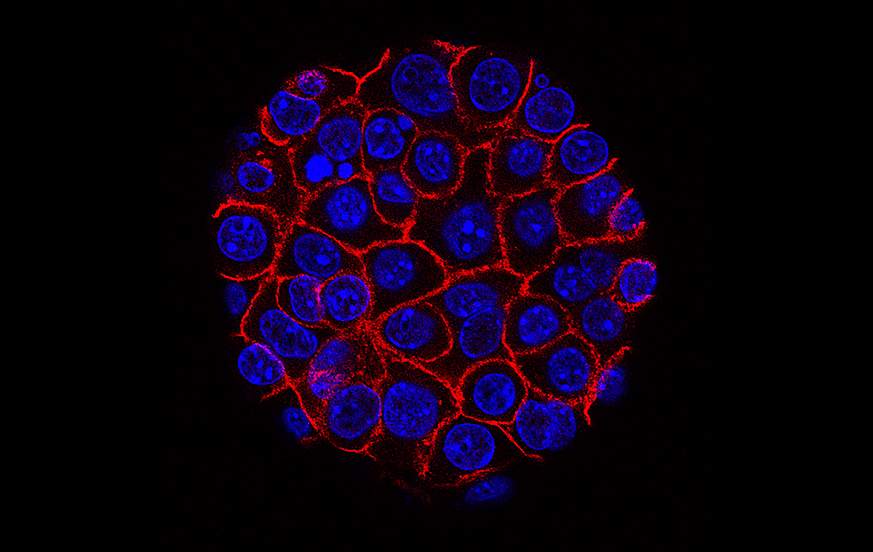 Pancreatic Cancer Cells