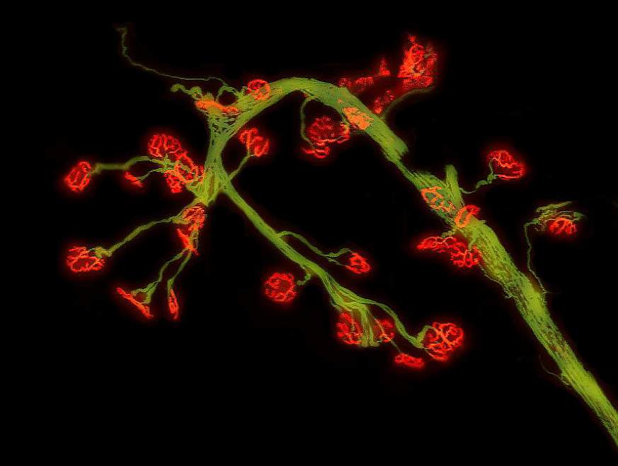 Leg Muscle from Mouse Model of Pompe Disease