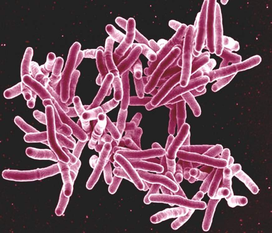 Mycobacterium tuberculosis Mycobacterium tuberculosis.