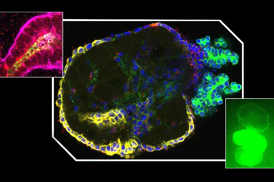 Tissue chips image Tissue chips image