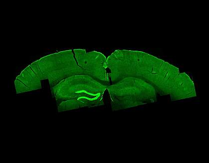 Temporal interference stimulation in mouse brain