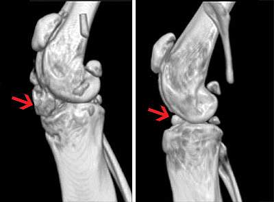 3D reconstructions of mouse knees from phase-contrast micro-CT imaging