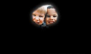 photo of retinitis pigmentosa photo of retinitis pigmentosa