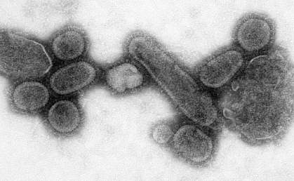 Picture of Influenza viruses from the 1918 Spanish flu epidemic recreated in the laboratory