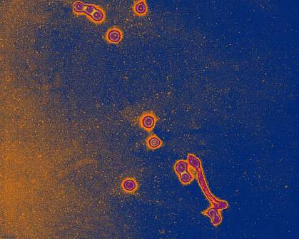 Electron micrograph of Influenza A