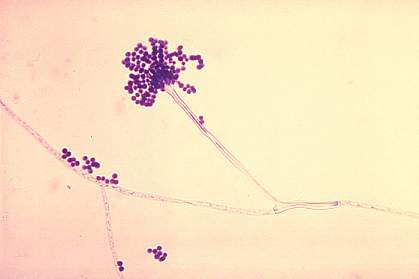 Microscope image of a fungus Microscope image of a fungus