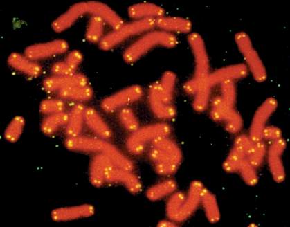 photo of chromosomes with dots at ends