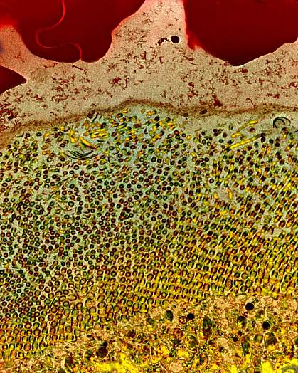 Microscopic image of a mosquito gut after a blood meal