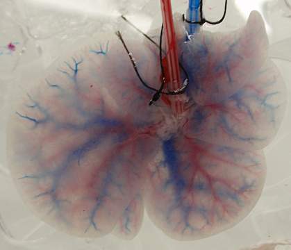 Photo of translucent liver with blue and red networks of blood vessels