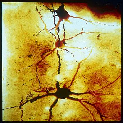 Motor neurons.