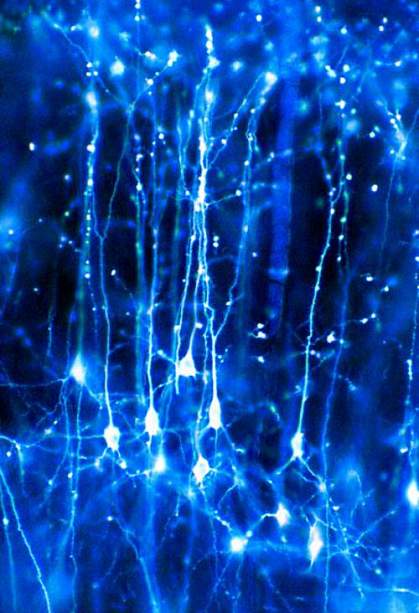 Network of branched neurons.