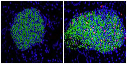 Pancreatic beta cells.