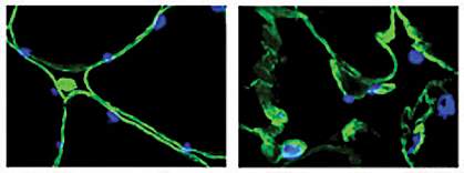 Two images illustrating cellular damage