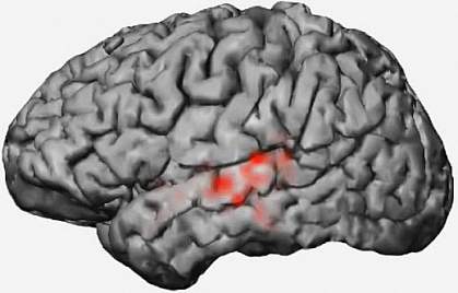 Electrical patterns in a brain.