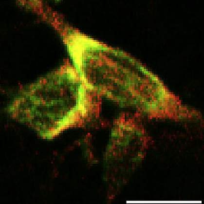 Human neuron.