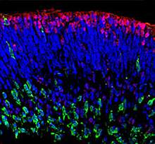 Induced pluripotent stem cells form a structure with layers of cells.