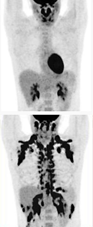 PET scans of human participants