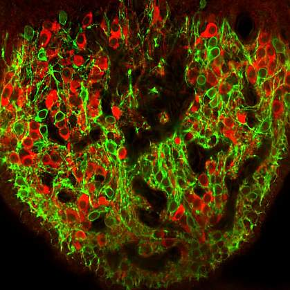 Mouse brain cells colored red and green.