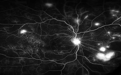 Retinal Blood Vessels.