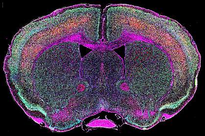 Mouse brain expressing env.