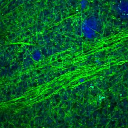 Brain tissue. Brain tissue.
