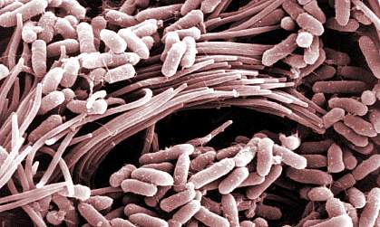 Bacteria in airway affected by cystic fibrosis