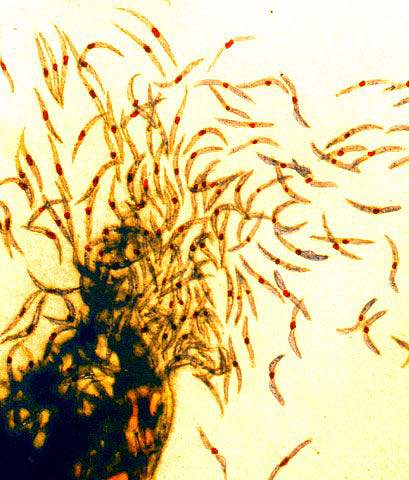 Malaria sporozoites Malaria sporozoites