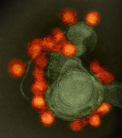 Zika virus Zika virus.