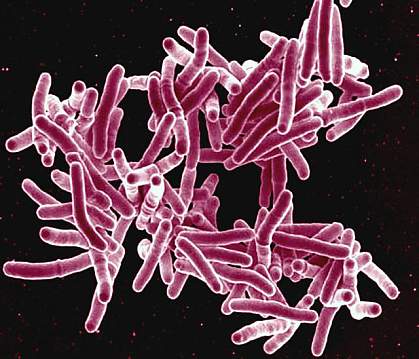 Mycobacterium tuberculosis.