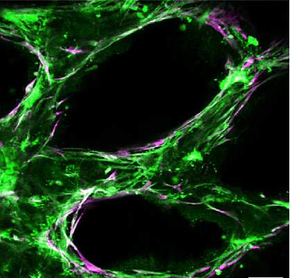 3-D printed blood vessels